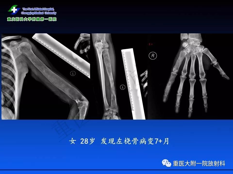 后日不语 相关产品